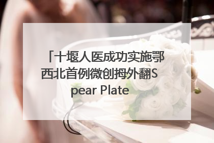 十堰人医成功实施鄂西北首例微创拇外翻Spear Plate髓内板矫形术